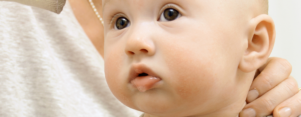 torticollis-therapy-works-lawrence-ks